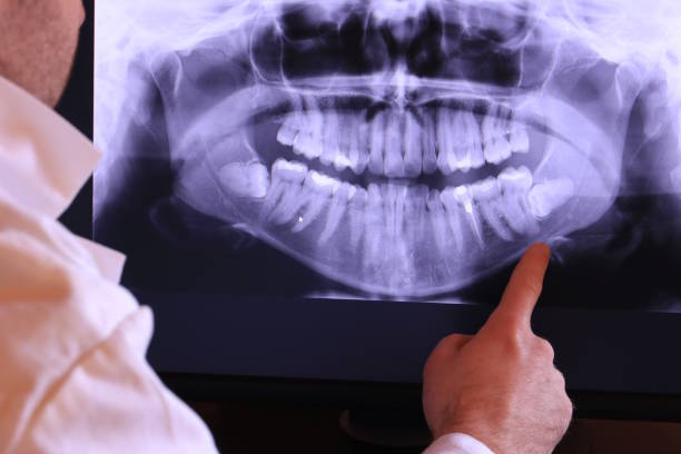 Best Emergency Dental Care for Broken or Chipped Teeth in Twin City, GA